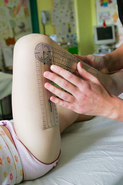 Bei juveniler Arthritis kann das Knie betroffen sein, Foto Susanne Troll